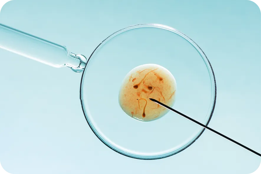 IVF Innovation