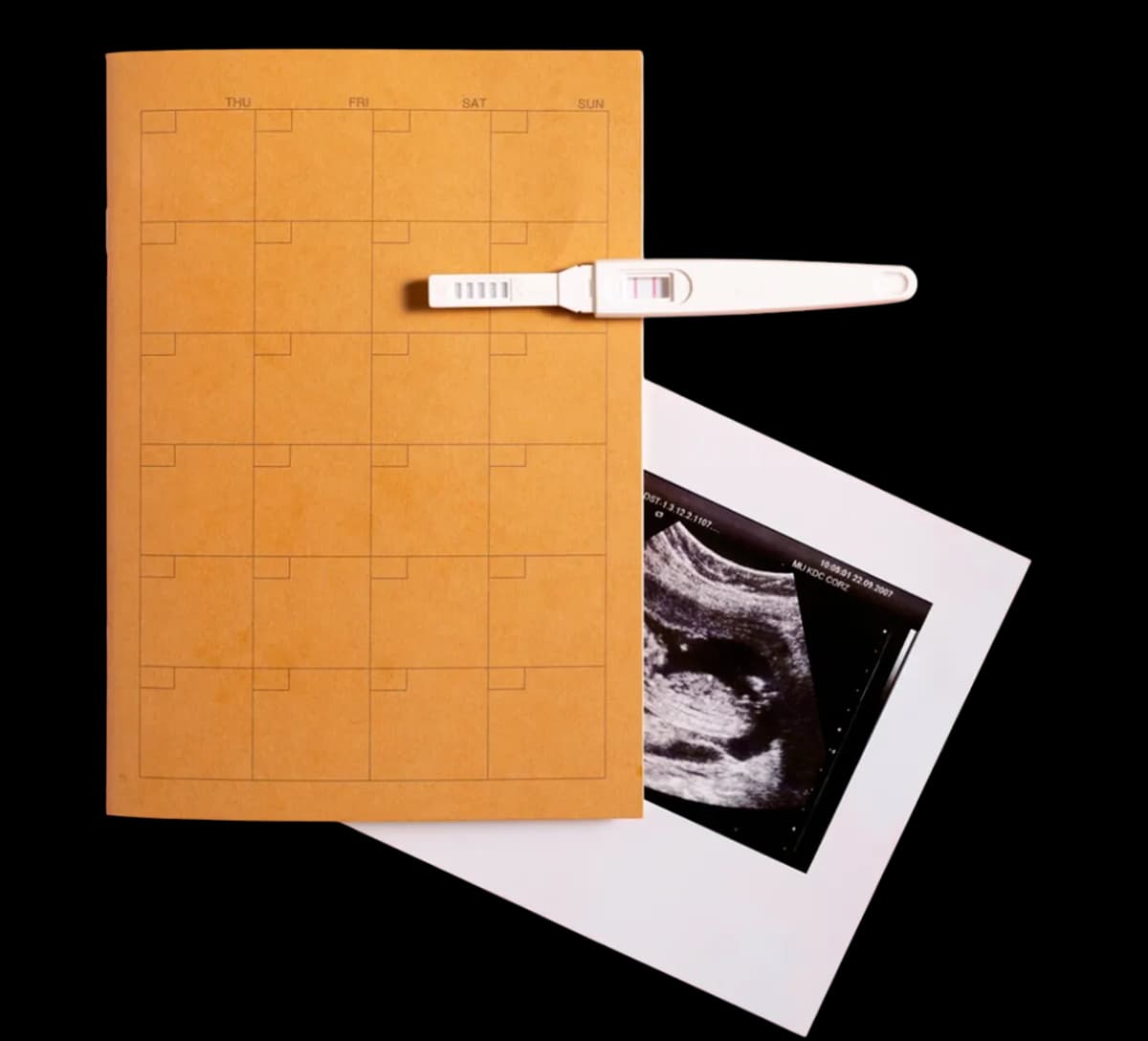 Transvaginal ultrasound