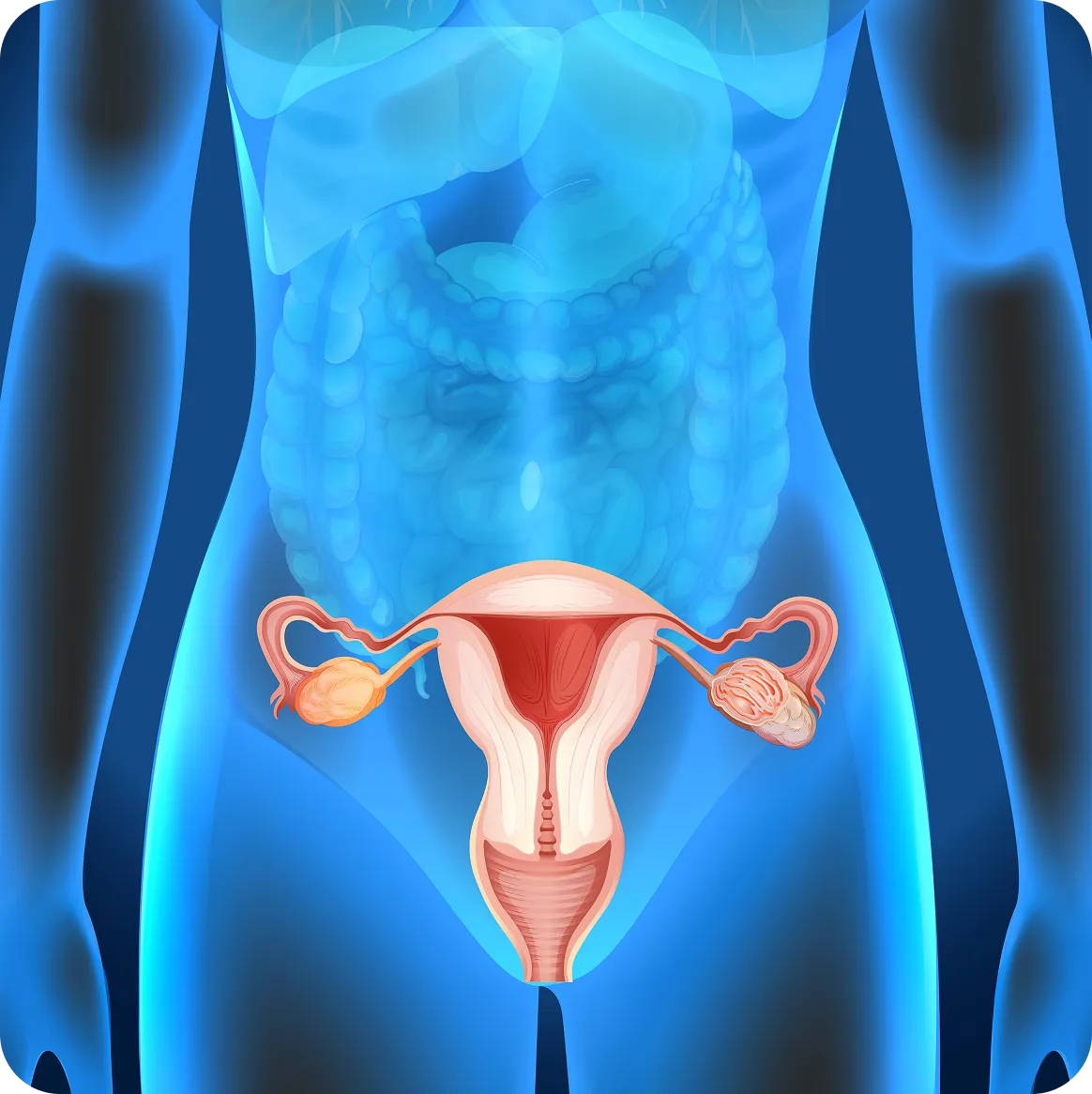 Hysterosalpingogram X‑ray