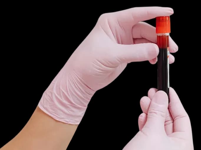Hormonal blood tests