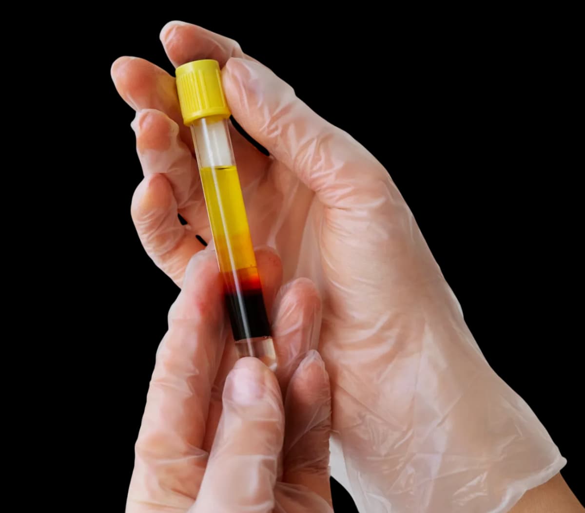 Lab testing